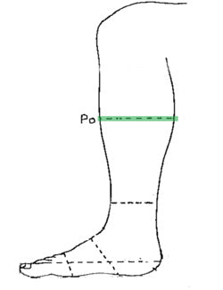 TERRIER CLOSE CONTACT- 2' SCELTA